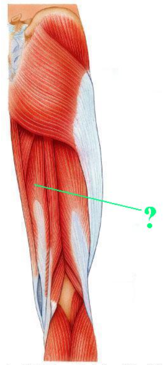 <p><span>Identify the indicated muscle.</span></p>