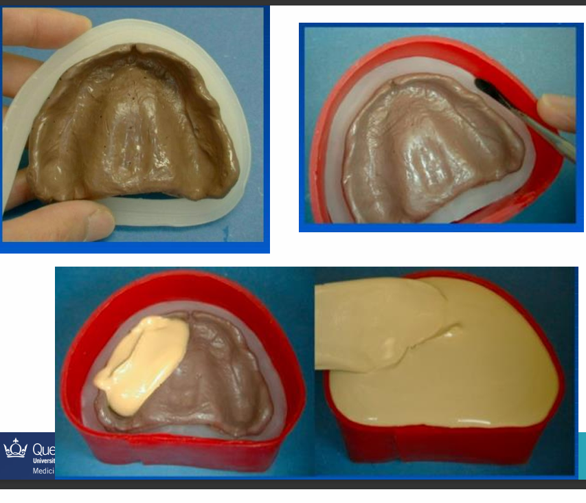 <ul><li><p>Processing wax</p></li><li><p>Build up vertical walls around the impression - box impressions before pouring with gypsum</p></li><li><p>As beading wax adapted around impression borders </p></li></ul><p>(box as sheets or beading as ribbon)</p>