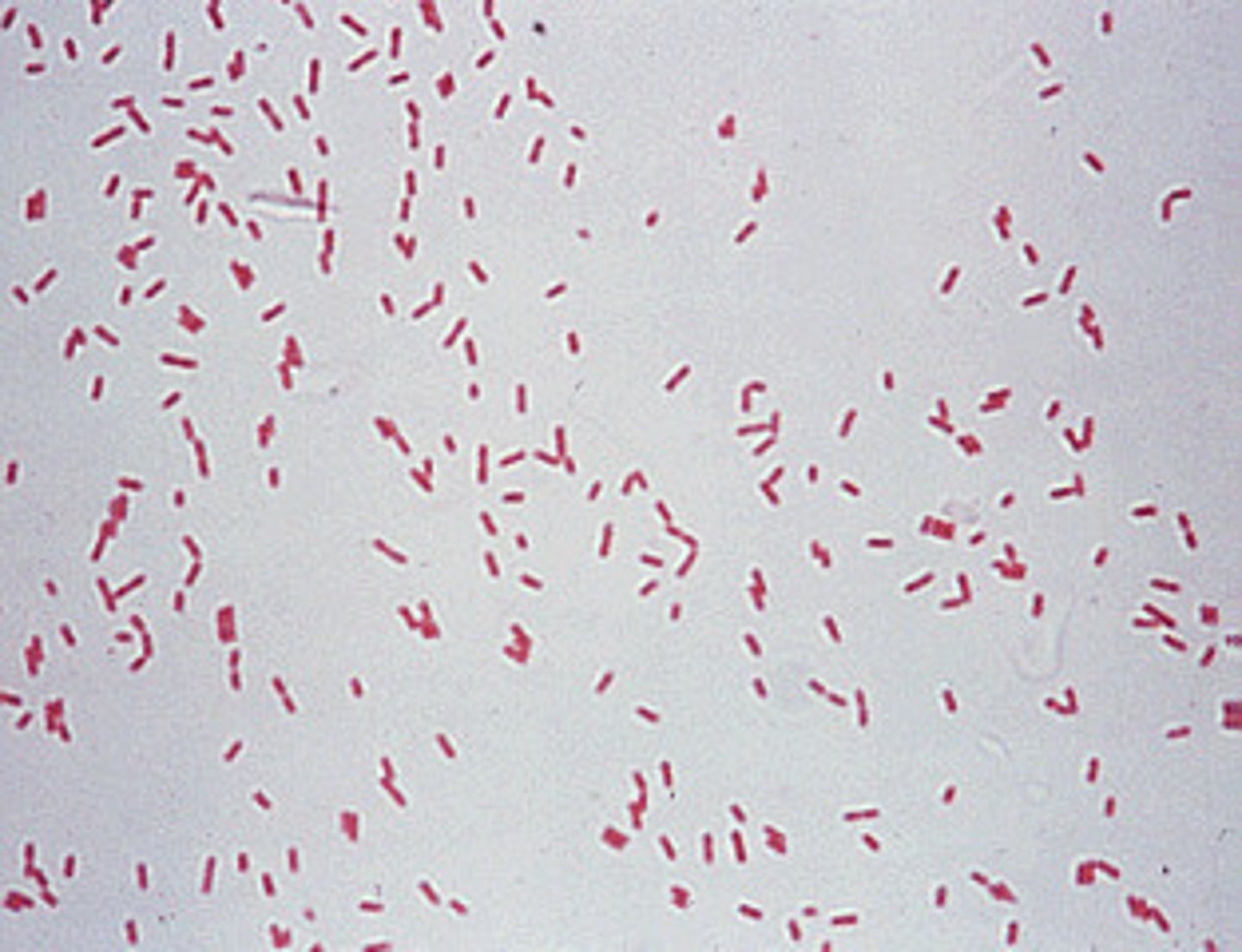 <p>A gram-negative, rod-shaped bacterium.</p>