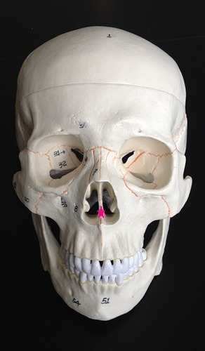 <p>Identify the bone.</p>