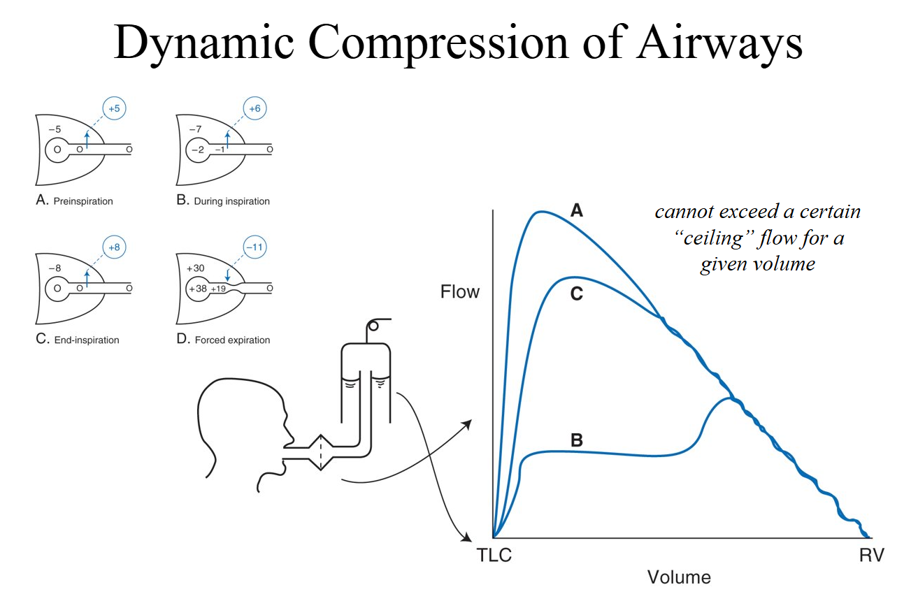 <p>Dynamic compression of airways</p>