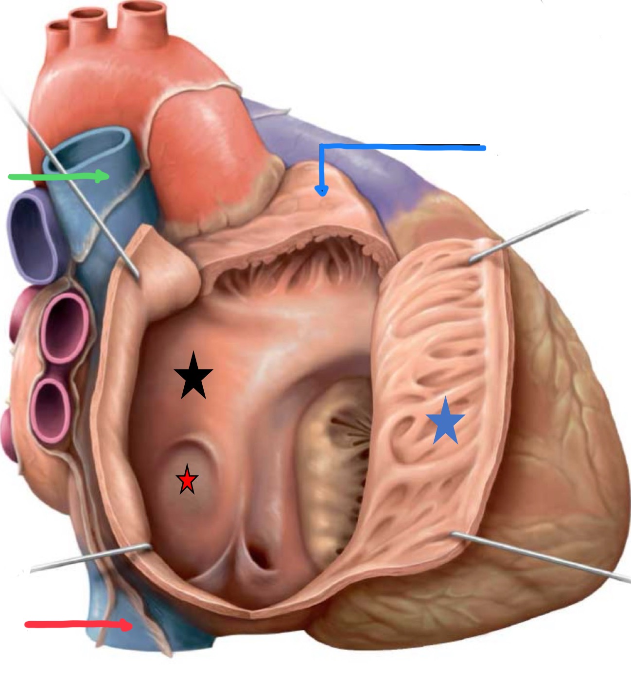 <p>What structure is identified by the blue star?</p>