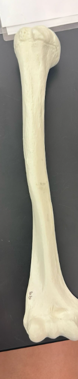 <p>What is this bone and is it right or left?</p>