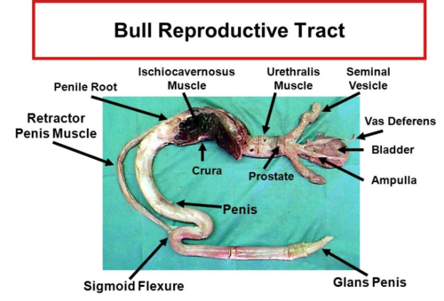 <p>an s-shaped bend in the penis which permits it to be retracted completely into the body</p><p>ruminants, boars and camelids have retractor penis muscles (pair of smooth muscles which relax to permit extension of the penis and contract to draw the penis back into the body)</p><p>these retractor penis muscles arise from the coccygeal vertebrae and are fused to the ventral penis just cranial to the sigmoid flexure</p>