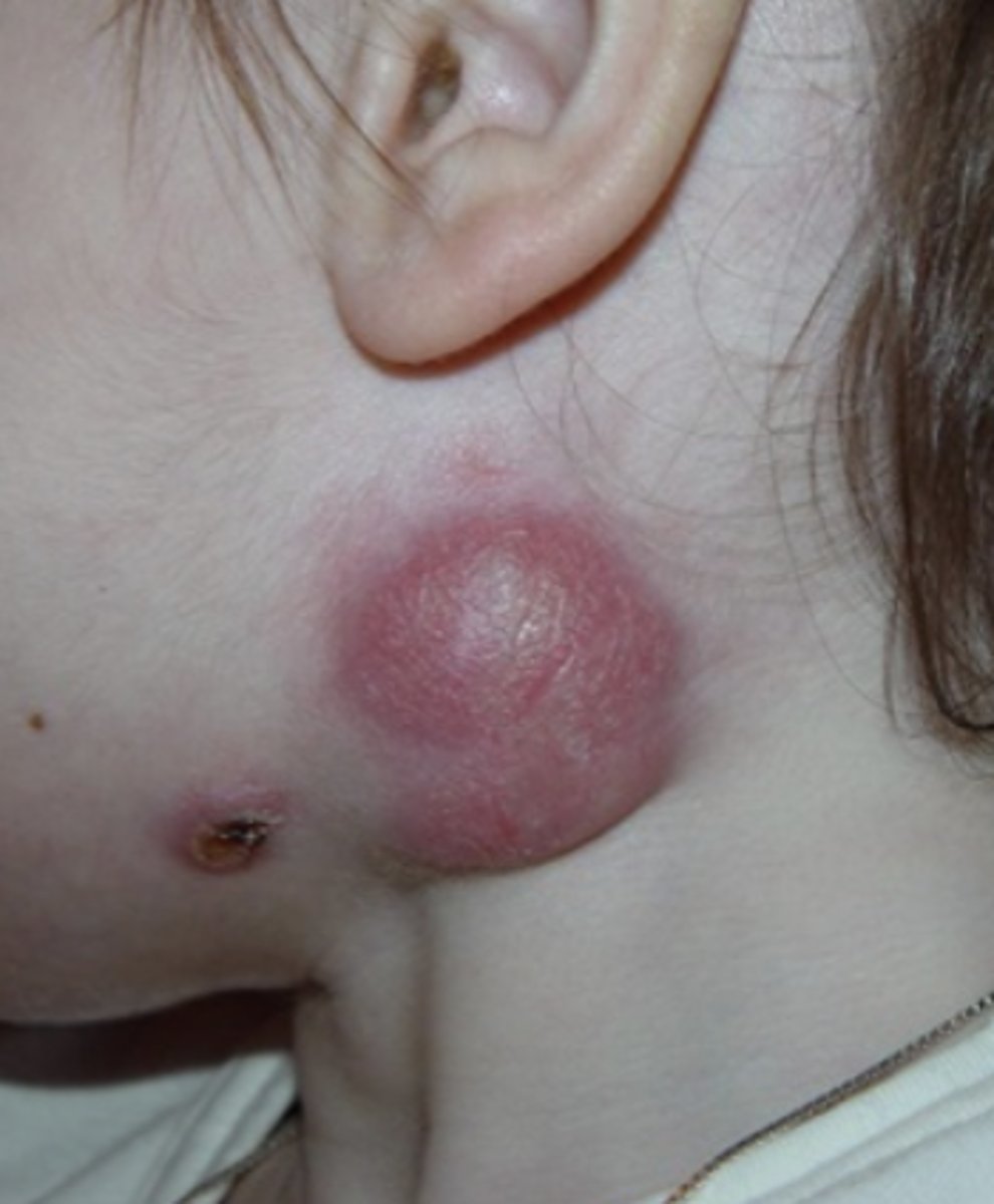 <p>cervical region</p>