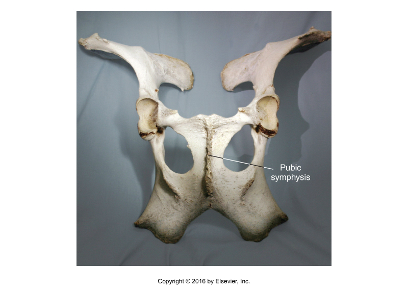 <p>Type of Joint?</p>