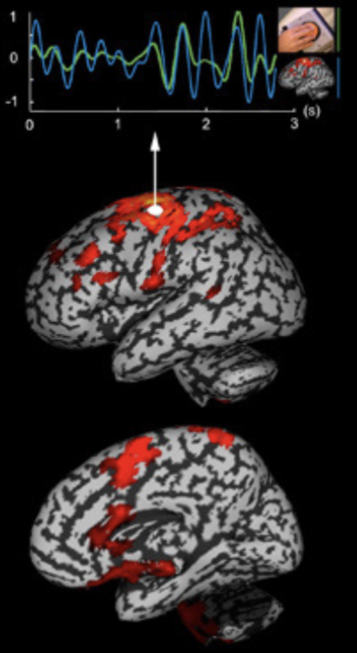 <ul><li><p>Electrical activity in the brain generates measurable magnetic fields</p><ul><li><p>Electromagnetic fields generated by the brain</p><ul><li><p>Cannot take activity from all over the brain </p></li><li><p>Difference from EEG; conductivity of the tissues inside the skull has little effect on the magnetic fields outside of the skull &nbsp;</p></li></ul></li></ul></li></ul><p></p>