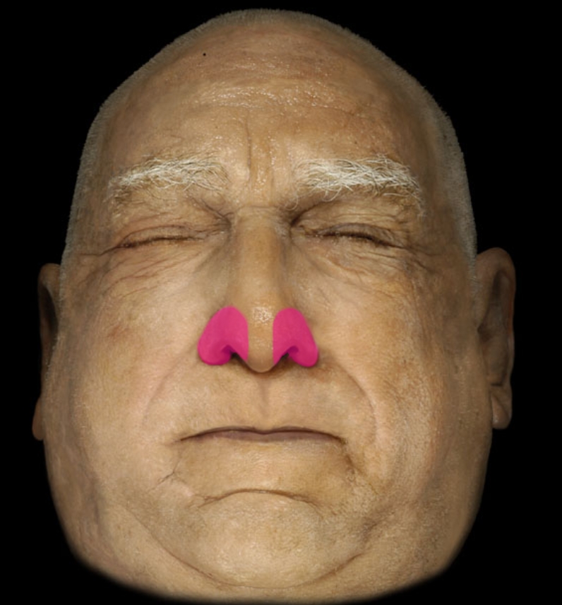 term image