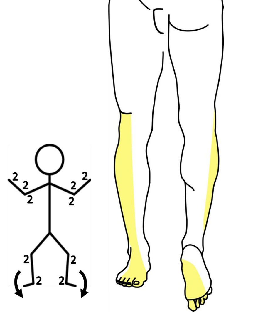 <p>A 60-year-old male presents to the office with the chief complaints of back pain, difficulty walking and sensory loss in his right lower extremity. Physical examination reveals sensory loss and reflexes as shown in the accompanying image. Strength testing will most likely reveal which of the following?</p><p>A. Dorsiflexion 0/5</p><p>B. Plantar flexion 1/5</p><p>C. Knee extension 2/5</p><p>D. Hip flexion 3/5</p><p>E. Hip extension 3/5</p>