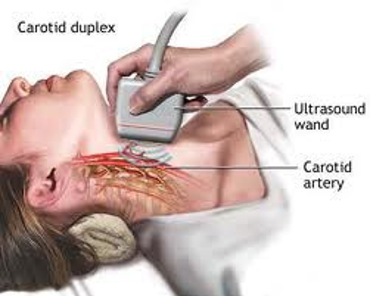 <p>doppler ultrasound</p>