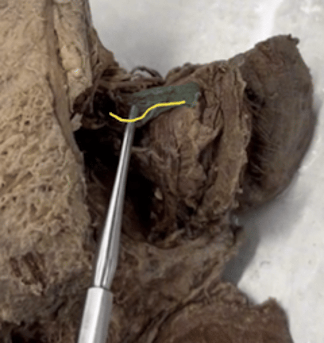 <p>Name the structure. (yellow)</p>