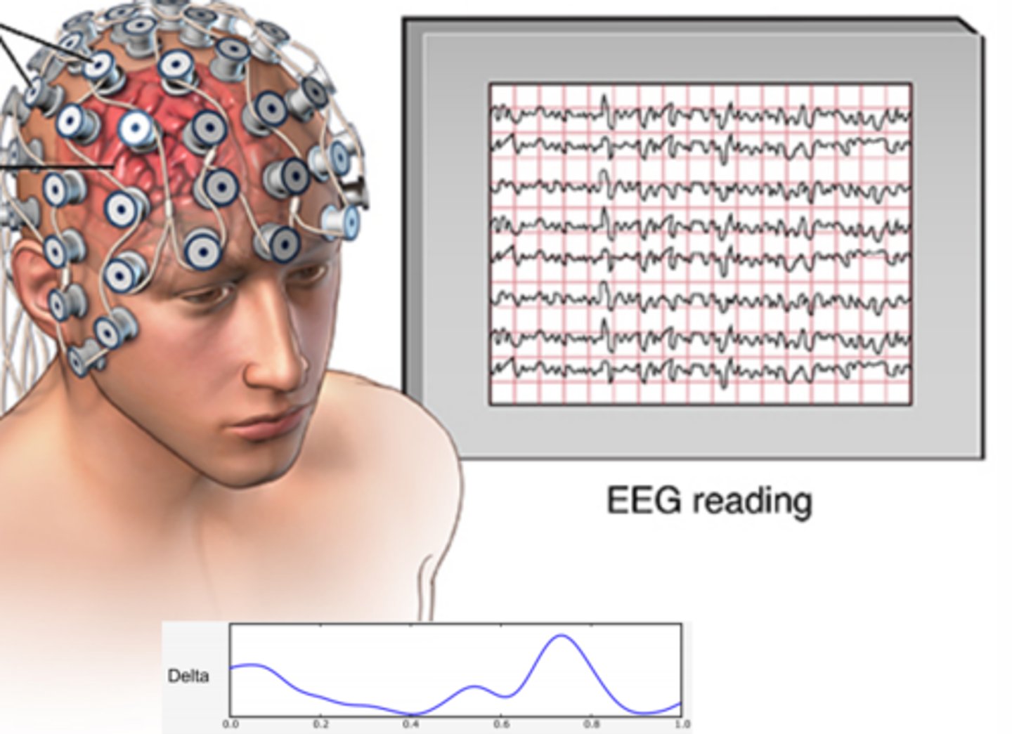 <p>shows brain's electrical activity by positioning electrodes over the scalp. Invented by Hans Berger. This device is often used in sleep studies.</p>