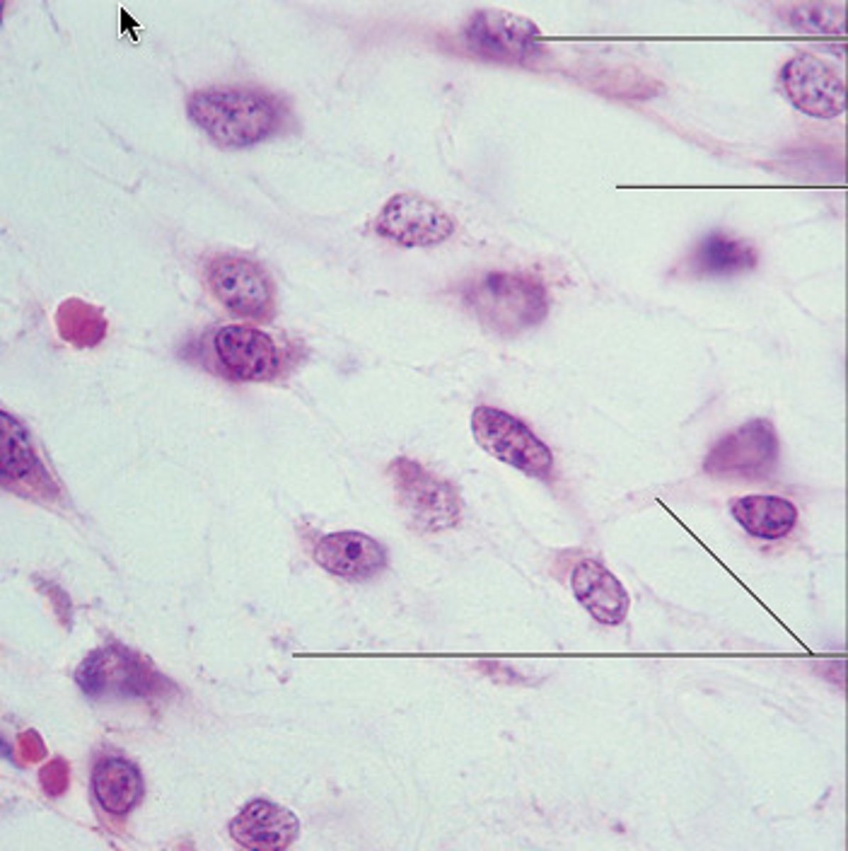 <p>embryonic connective tissue; gel-like ground substance containing fibers; star-shaped mesenchymal cells</p>