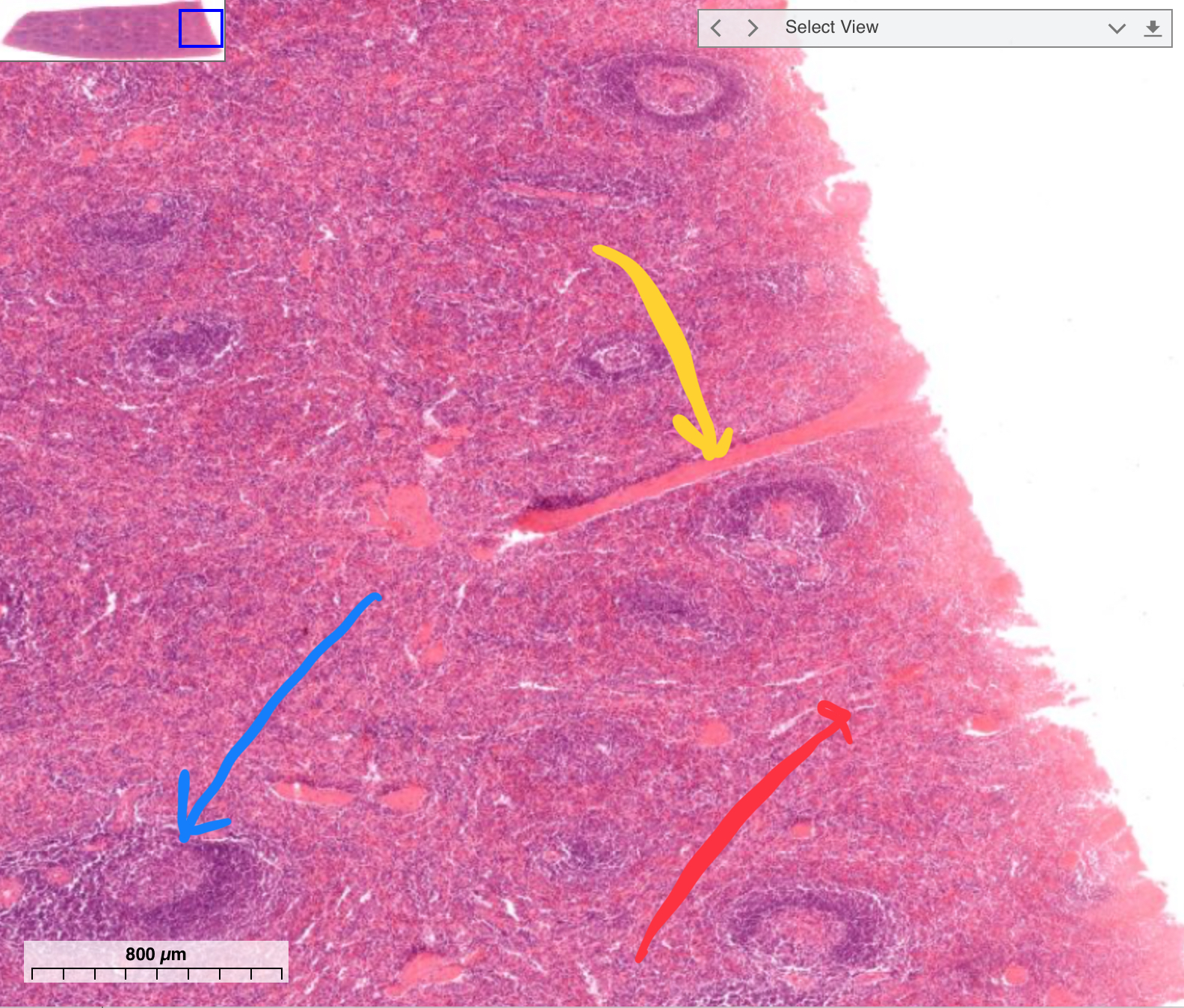 <p>What’s in blue?</p>