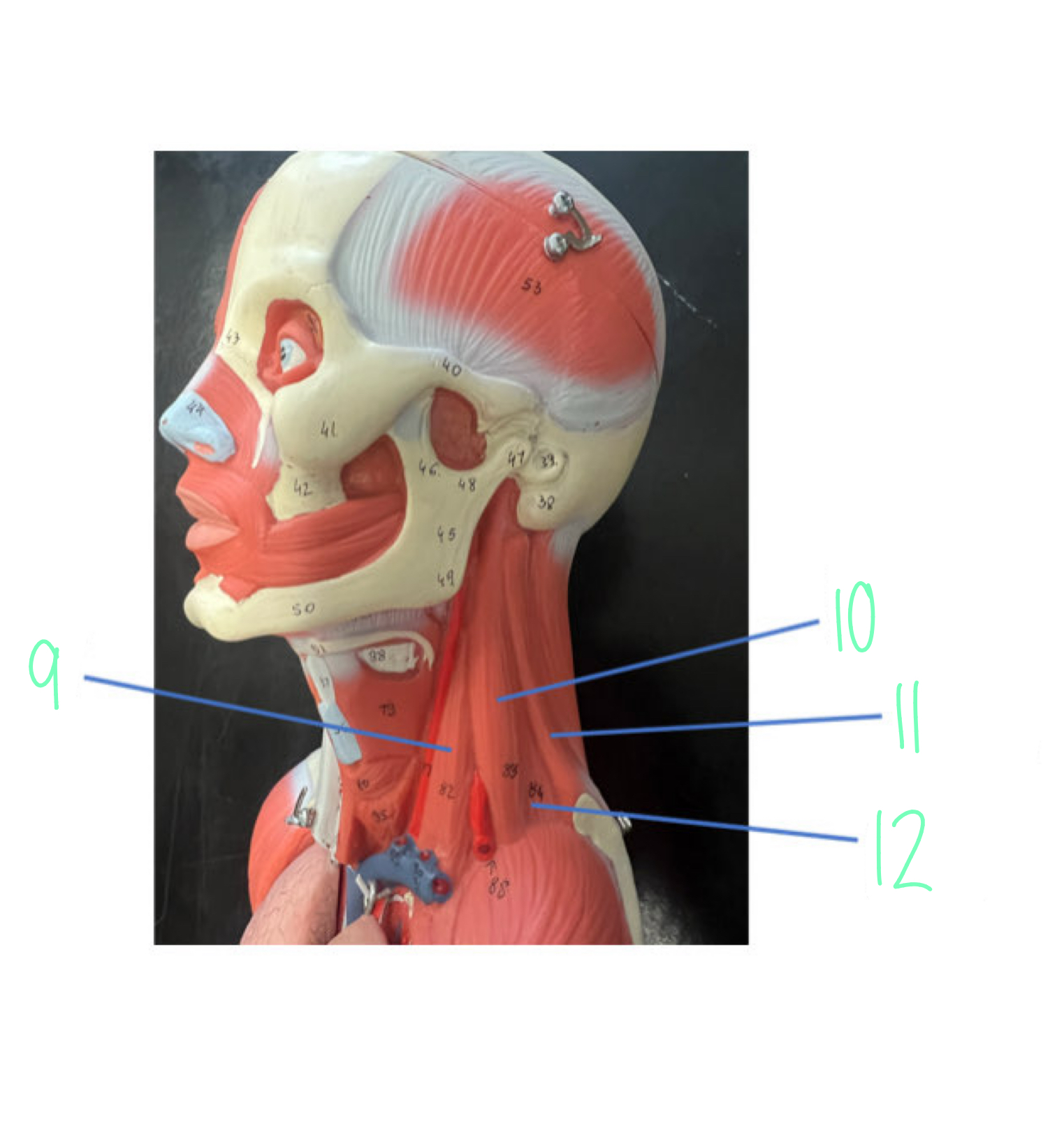 <p>11</p>