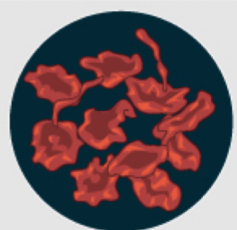 <p>What type of Tonicity is this?</p>