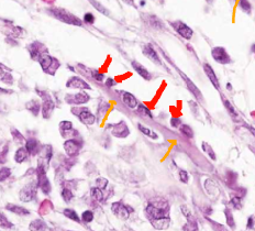 <p>Foetal head, coronal section, haematoxylin and eosin</p>