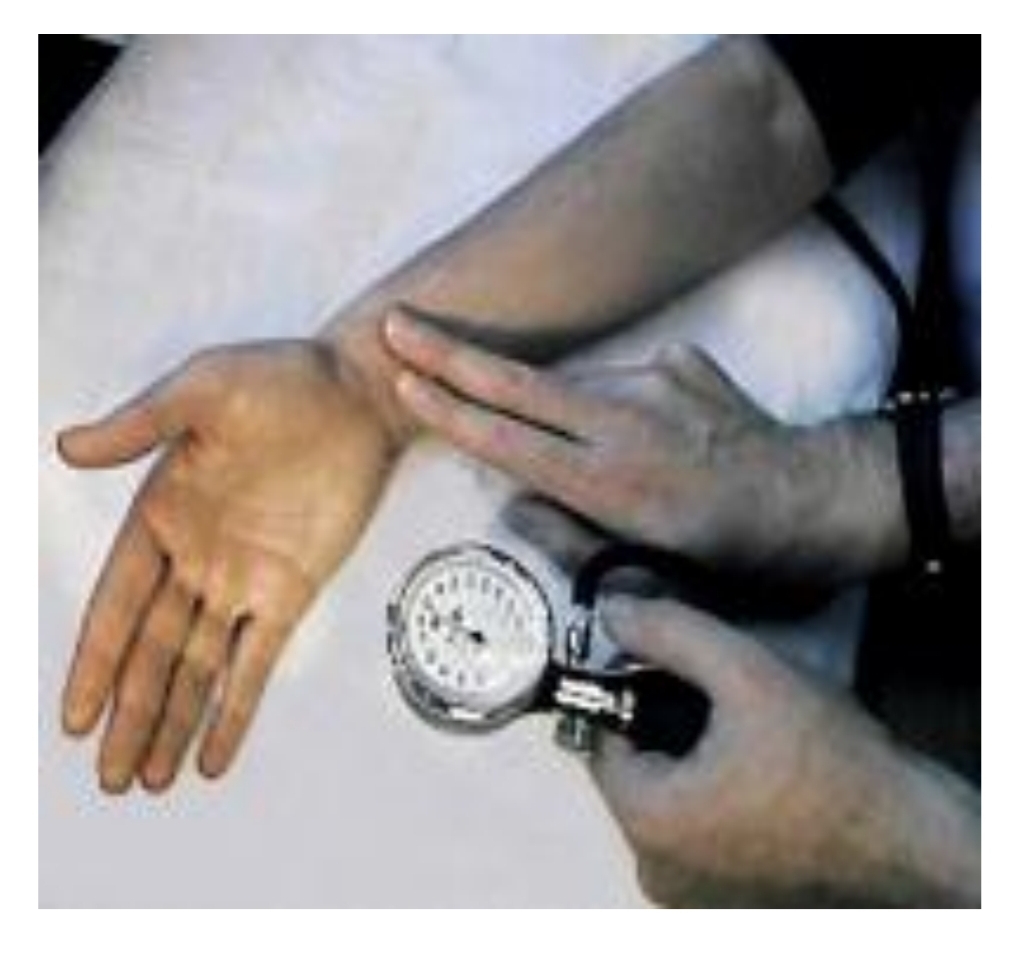<p>Name the method used to measure arterial blood pressure by feeling pulse.</p>