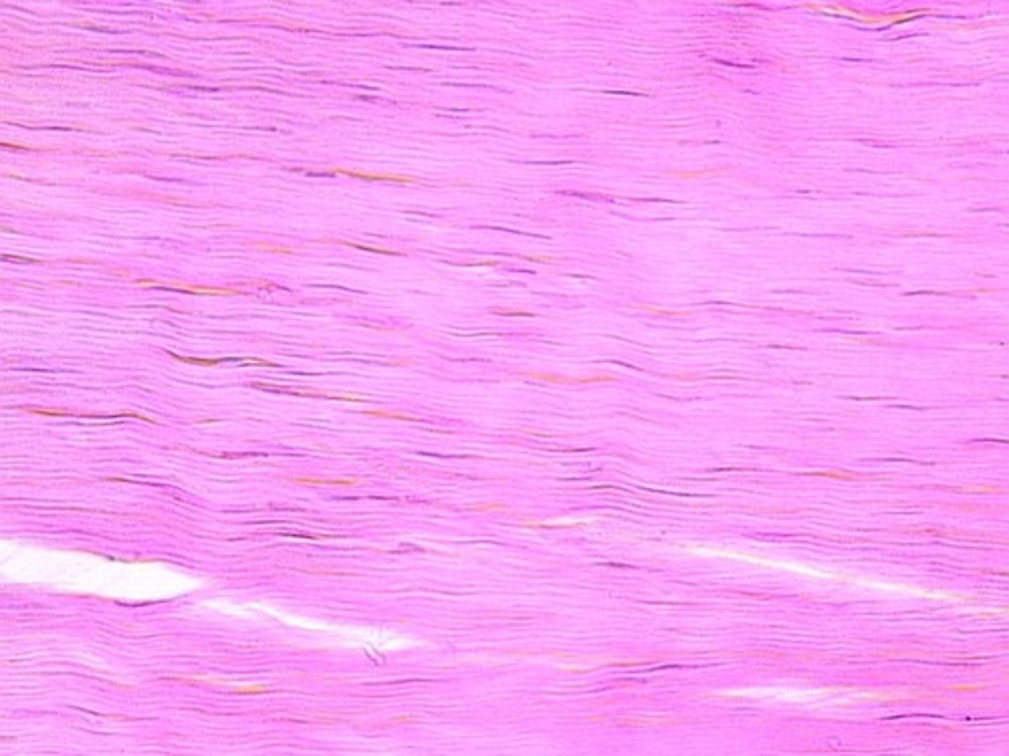 <p>- collagen fibers running parallel to one another</p><p>- resist stretching</p><p>- ligaments/muscle tendons</p><p>- Ligaments between vertebrae in vertebral column</p><p>- INCLUDES: collagen fibers, fibroblast nuclei</p>