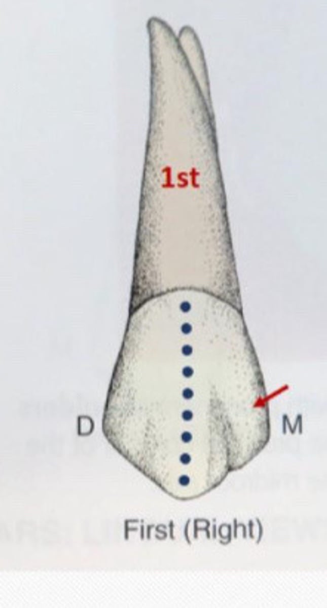 <p>First premolars Rarely find a __ depression</p>