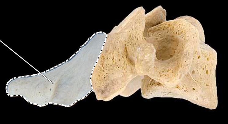 <p>What part of the vertebra is highlighted?</p><p>What type of vertebra is this (which region is this vertebra from)?</p><p>(Lateral view, right side).</p>