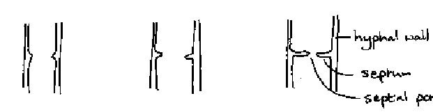 <p>centripetally- narrowing diaphragm (opposite of plants), strengthen, can block off injured parts, restrict cytoplasmic continuity-allows differentiation </p>