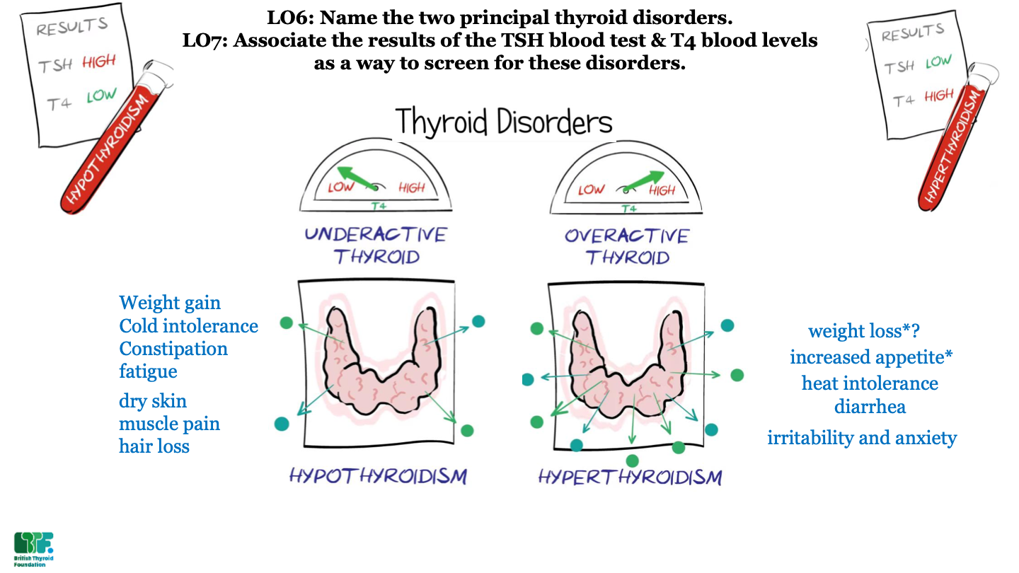 overactive thyroid; too much thyroid hormone