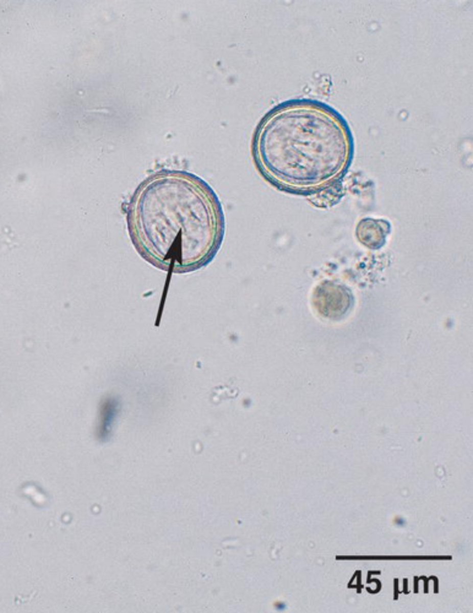 <p>What parasite is this if it is from a cat</p>