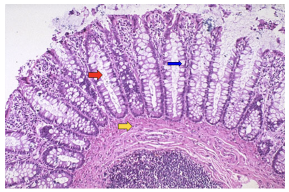 <p><span><strong>Identify structures found in the colon.</strong></span></p>
