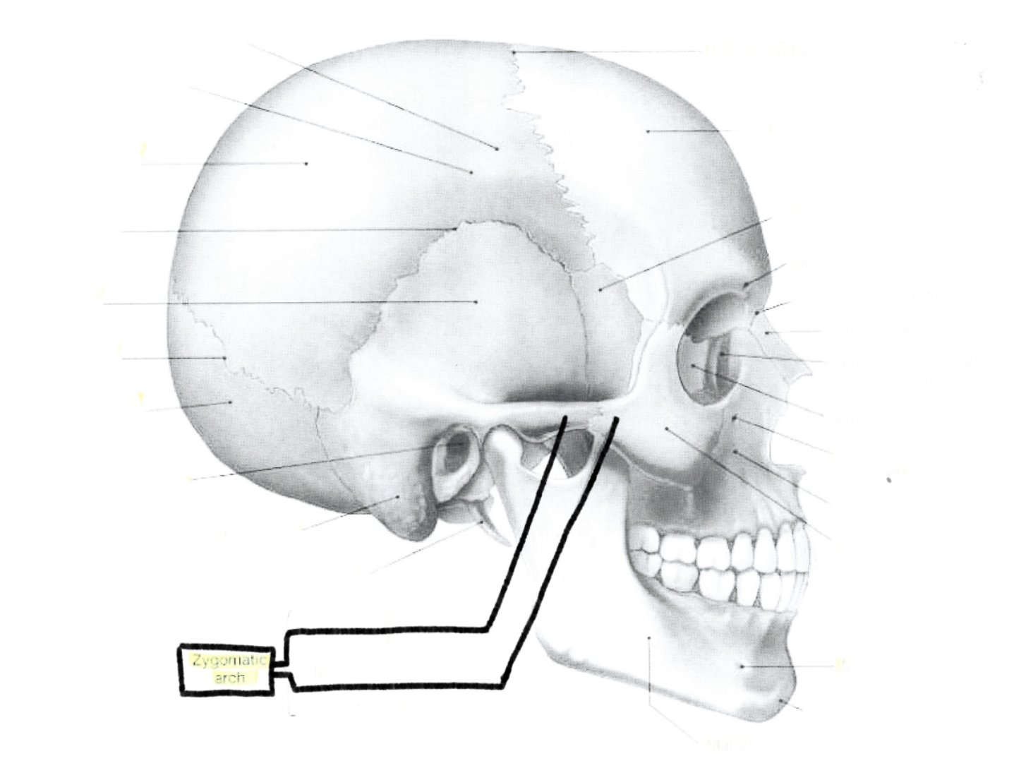 <p>Zygomatic arch</p>