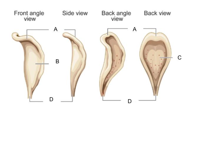 <p>B</p>