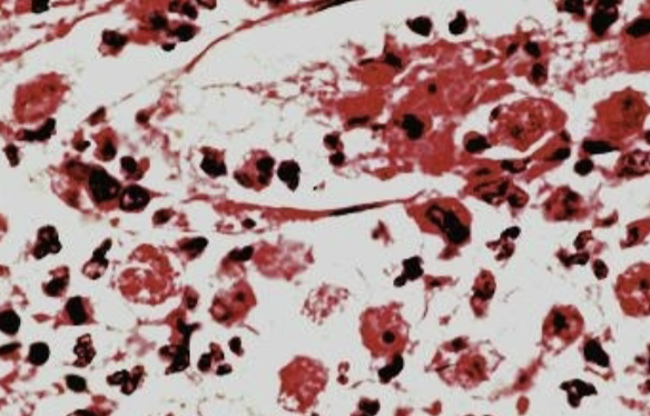 <p>in brain tissue</p>