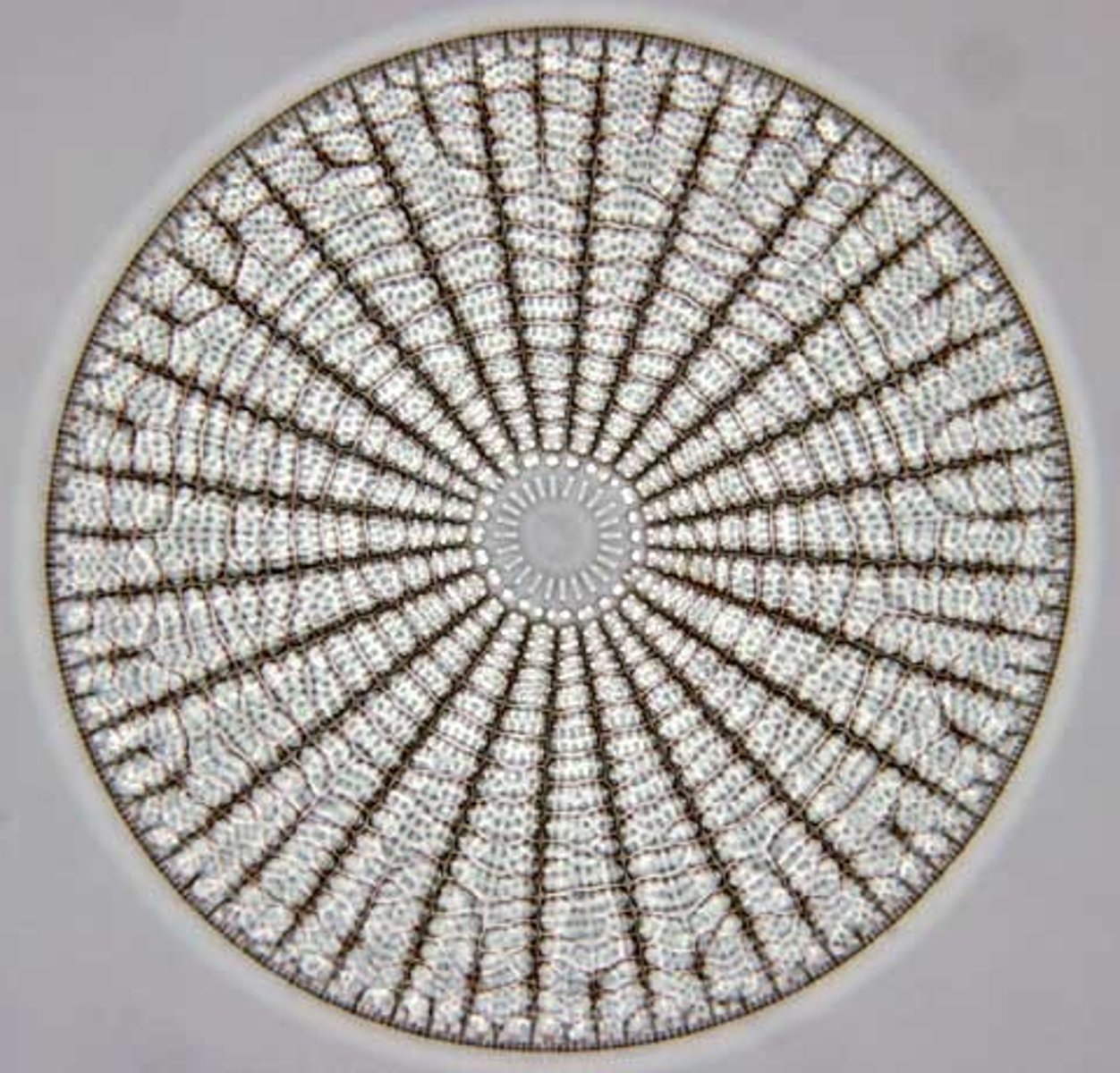 <p>radial; centric</p>