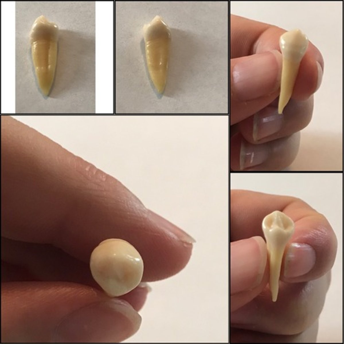 <p>What tooth is this ?</p>