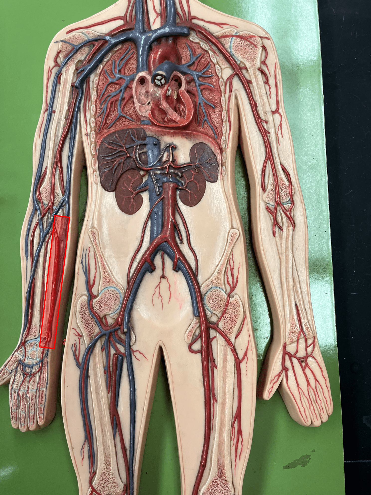 <p>• An artery of the upper limb.</p>
<p>• Originates from the brachial artery.</p>
<p>• Supplies the medial forearm muscles.</p>