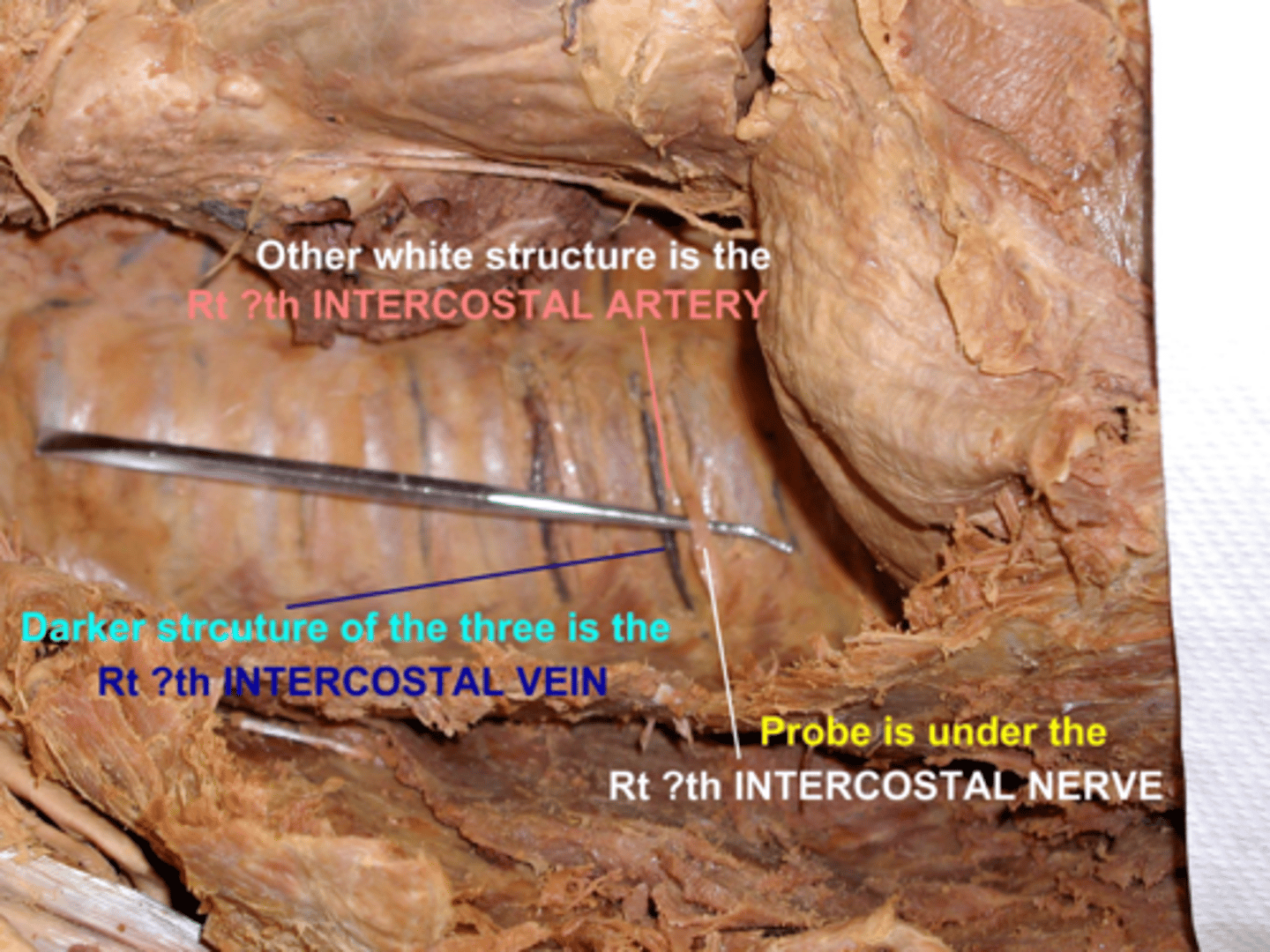 <p>on rib cage</p>
