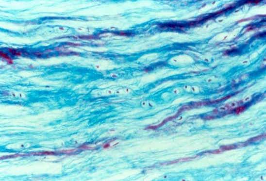 <p>Name this tissue</p>