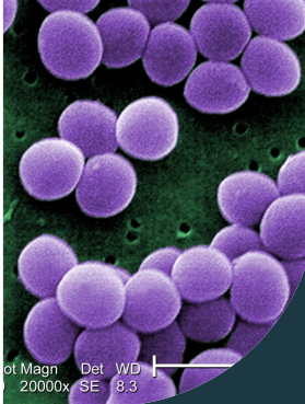 <p>Staphylococcus aureus</p>