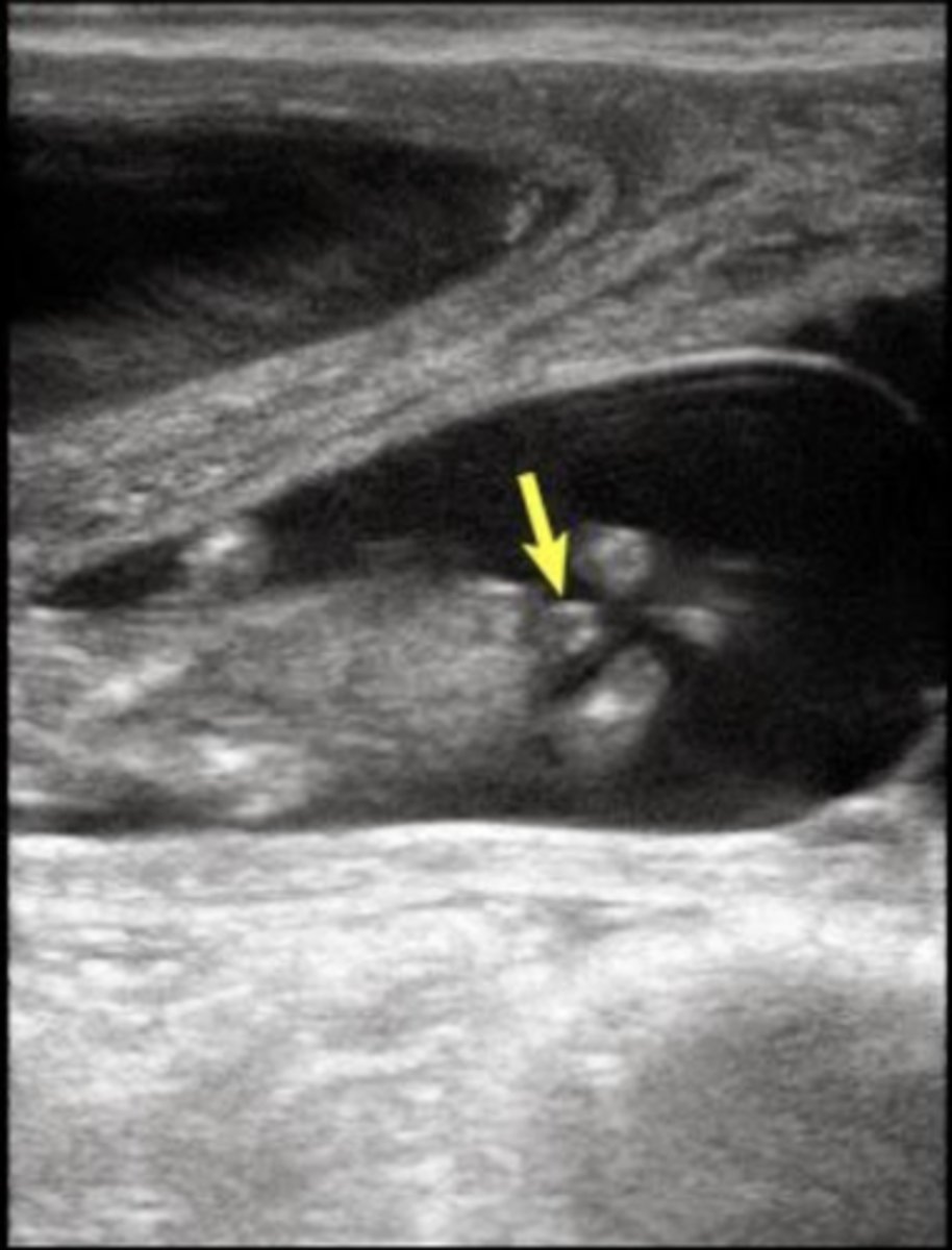 <p>What sex is the fetus (bovine)?</p>
