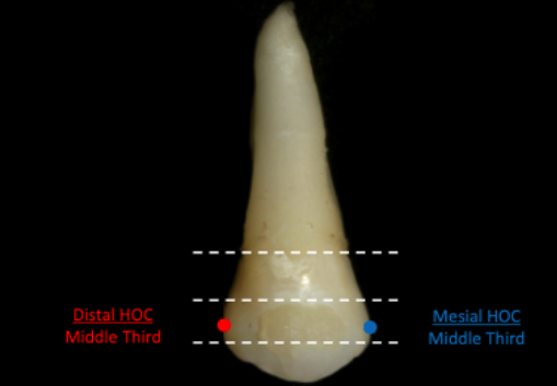 <p>middle 1/3</p>