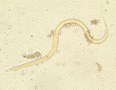 <p>in dogs, cats, mammals, primates, human stool</p><p>dermatitis, pneumonia, eosinophilia, sepsis, death</p><p>worldwide, tropic/subtropics, south US</p>