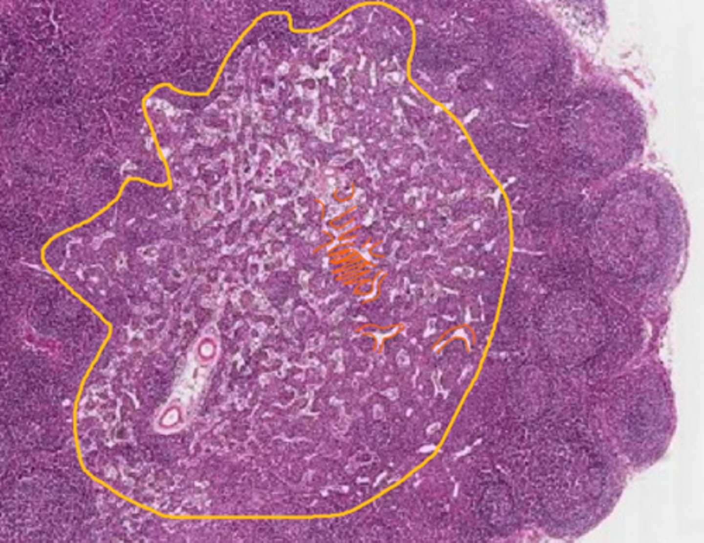 <p>the yellow is the medulla of a lymph node, what are the orange outlined structures? (the stained parts not the clear space)</p>