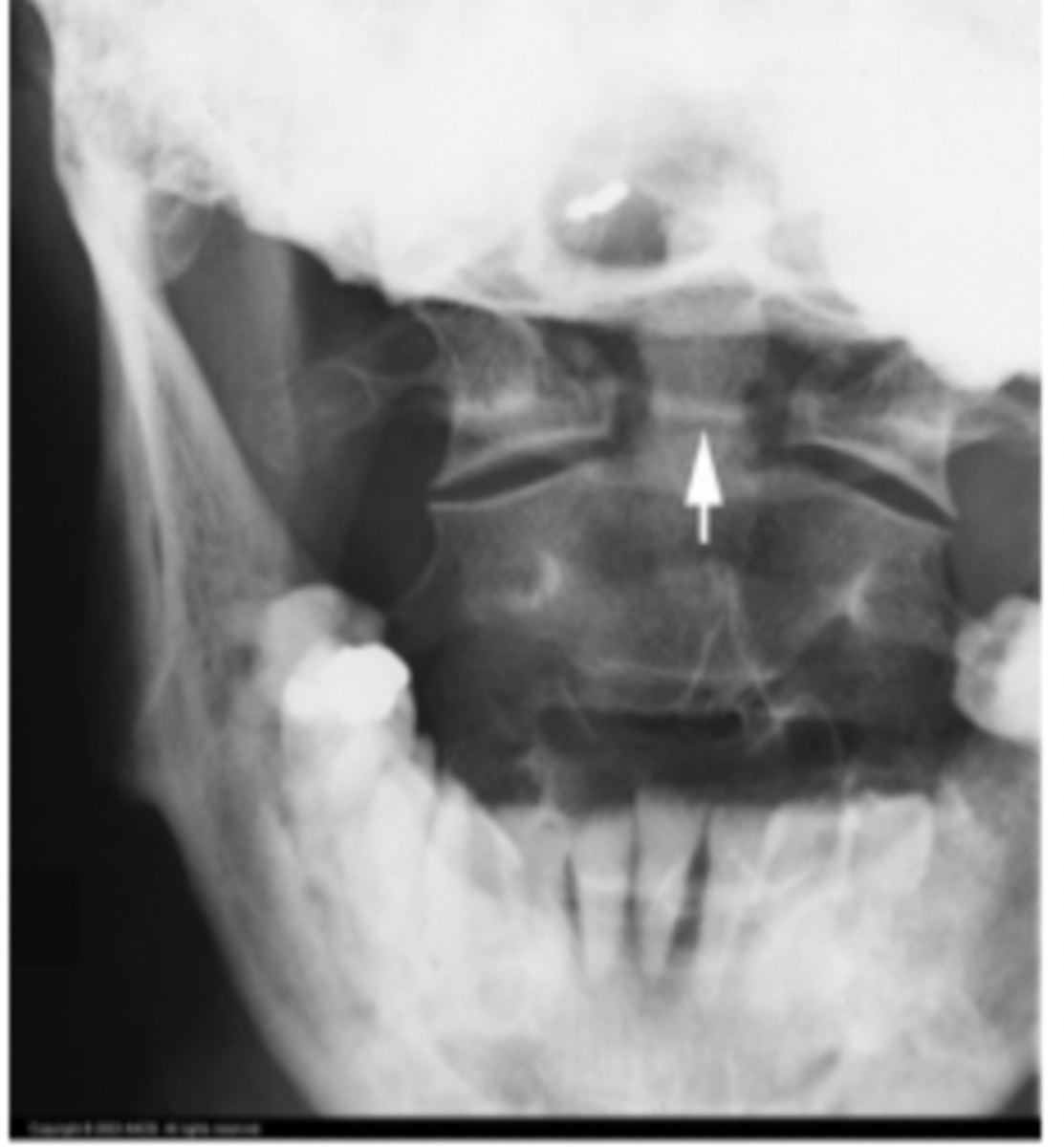 <p>What is the issue?</p>