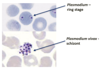 <p>Plasmodium</p>