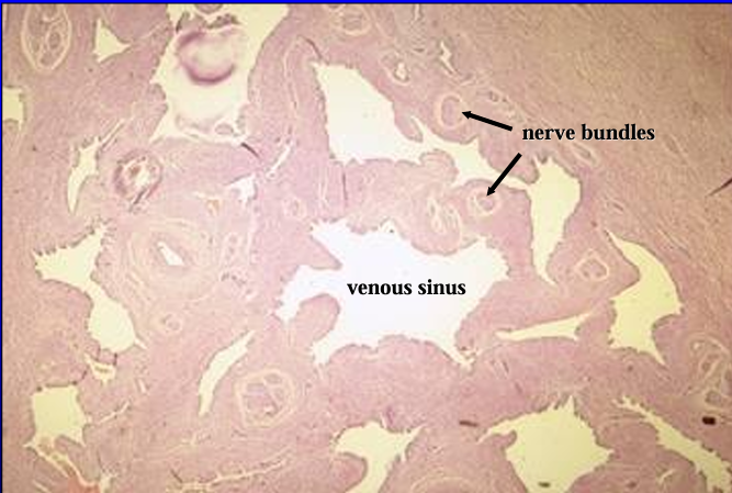 <p>Equine penis. </p><p>The corpus spongiosum glandis (erectile body of the glans penis) is seen at a slightly higher magnification. </p><p>Numerous nerve bundles are present in the connective tissue separating the venous sinuses</p>