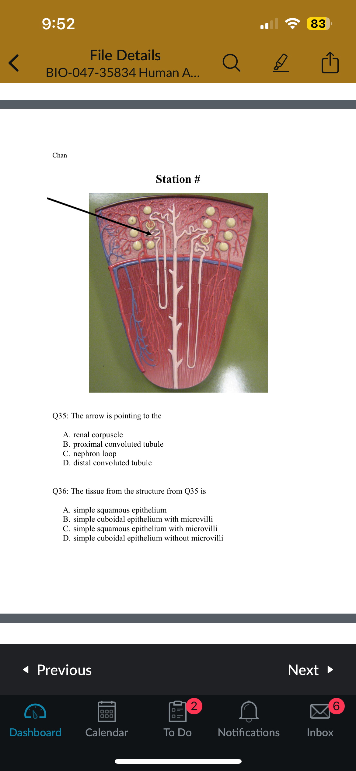 <p>Q36: The tissue from the structure from Q35 is</p>