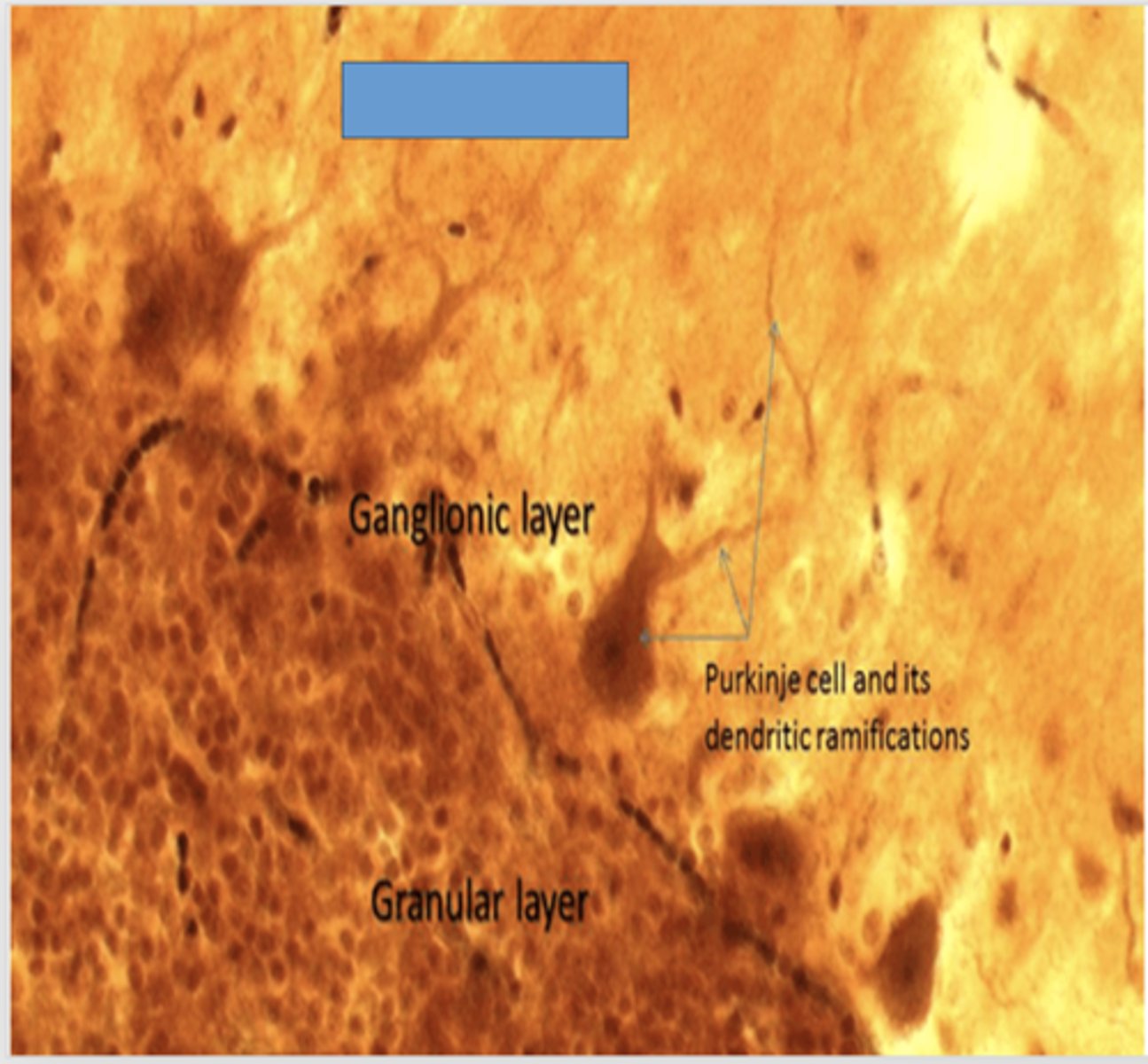 <p>Identify the layer of the cerebellum</p>