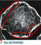 <ul><li><p>Leading edge around the entire cell</p></li><li><p>not normal</p></li></ul><p></p>