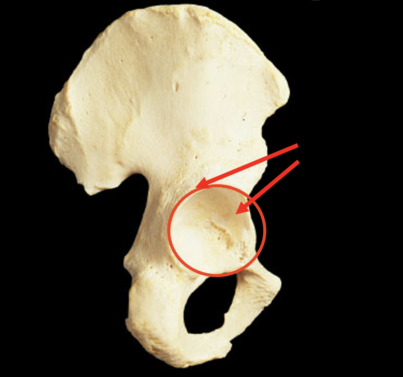 Name this region of the pelvis