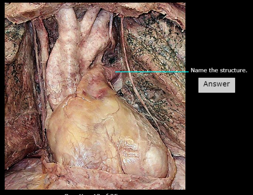 <p>What artery is this</p>